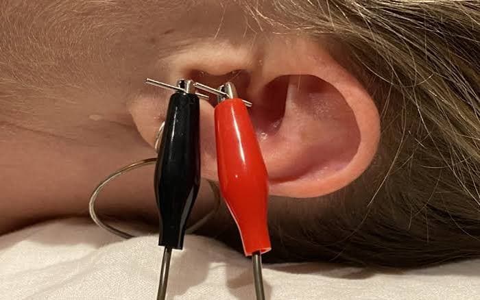Upgrade your Nervous System, Precision Clinical VNS in Boulder